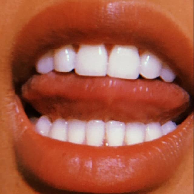 The Signature Smile Plan at SKN Laboratory in Laredo, TX